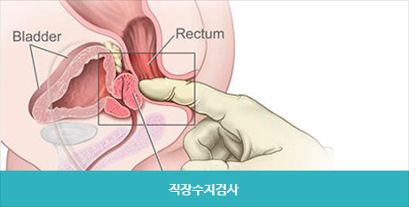 직장수지검사